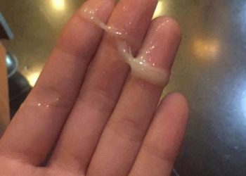 Cách chữa tinh trùng màu vàng bằng thuốc Đông y