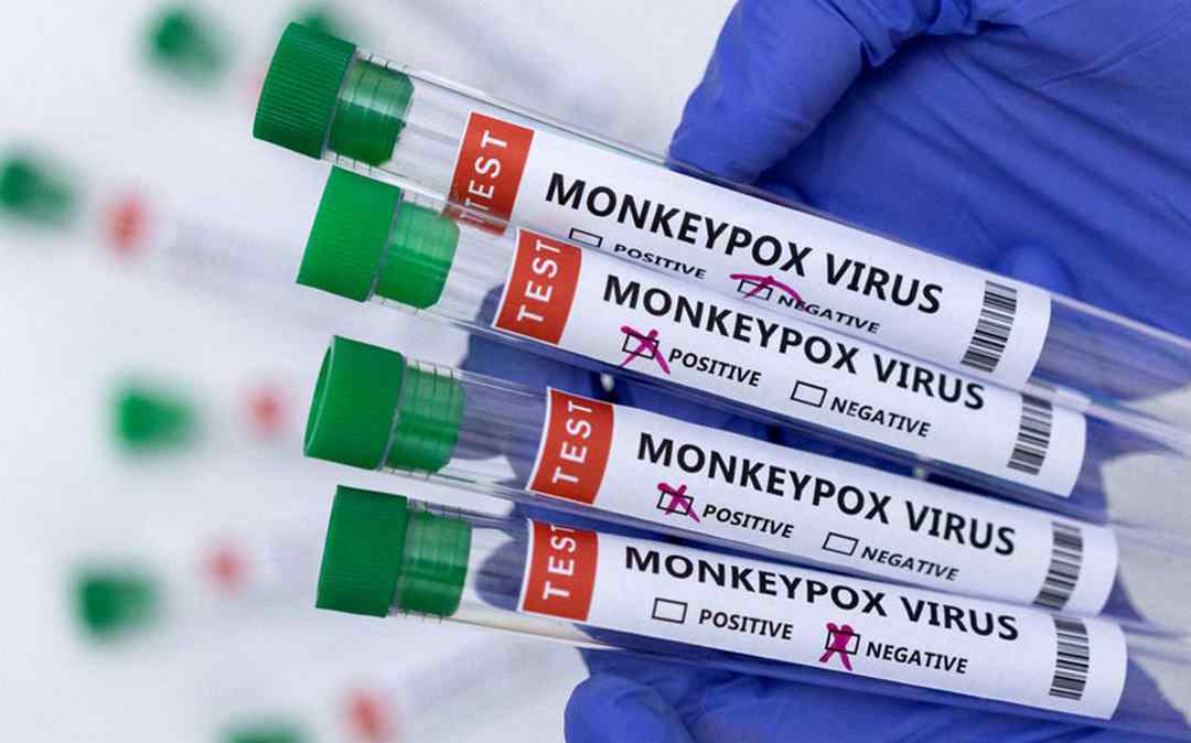 Đậu mùa khỉ vẫn chưa có loại vắc xin riêng
