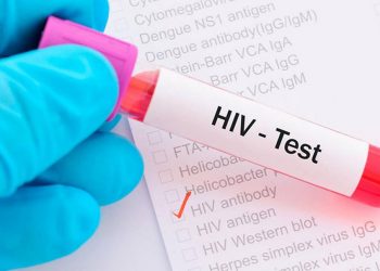 Khi có các dấu hiệu HIV, người bệnh cần tới cơ sở y tế 