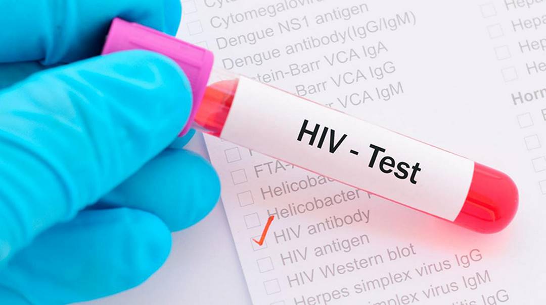 Khi có các dấu hiệu HIV, người bệnh cần tới cơ sở y tế 