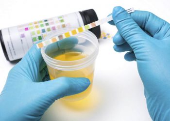 Nước tiểu màu vàng có ảnh hưởng tới sức khỏe như nào?