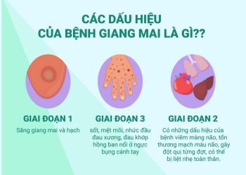 Mỗi giai đoạn mắc bệnh sẽ có những triệu chứng và dấu hiệu khác