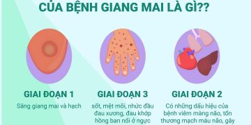 Mỗi giai đoạn mắc bệnh sẽ có những triệu chứng và dấu hiệu khác