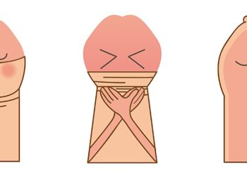 Một số tình trạng của bao quy đầu mọi người cần biết