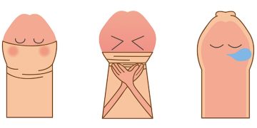 Một số tình trạng của bao quy đầu mọi người cần biết