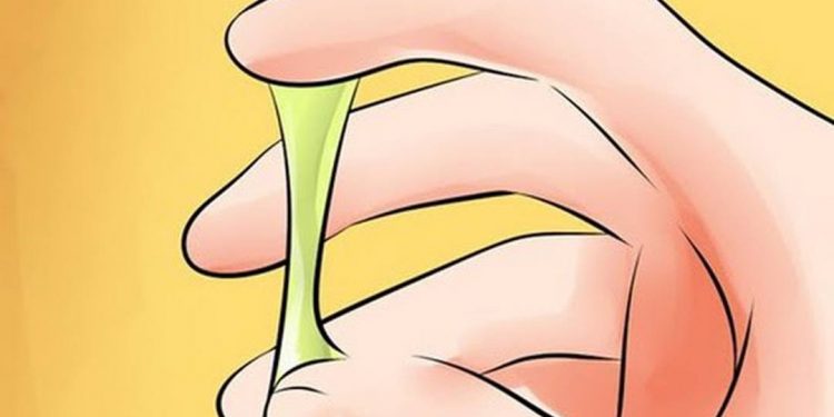 Khí hư màu vàng thường sẽ đặc quánh và độ kết dính nhiều hơn