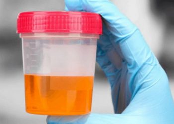 Khi cơ thể thiếu nước, mất nước dẫn tới nước tiểu có màu cam