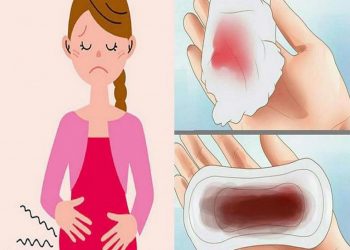 Biến chứng của rong kinh cực kỳ nguy hiểm