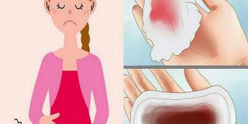 Biến chứng của rong kinh cực kỳ nguy hiểm