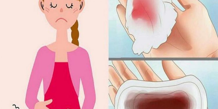 Biến chứng của rong kinh cực kỳ nguy hiểm