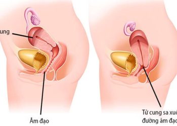 Hiện tượng về bệnh thường gặp ở phụ nữ sau sinh