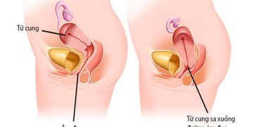 Hiện tượng về bệnh thường gặp ở phụ nữ sau sinh