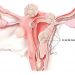 U xơ tử cung là bệnh lý lành tính xuất hiện ở đông đảo phụ nữ hiện nay