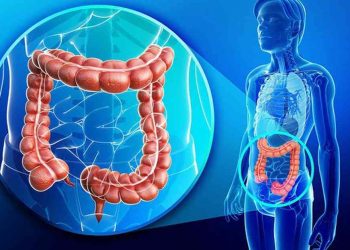 Ung thư trực tràng là tế bào ung thư khởi phát ở phần trực tràng