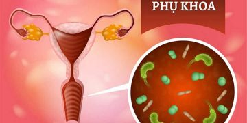 Viêm nhiễm phụ khoa là tình trạng bệnh lý khá phổ biến