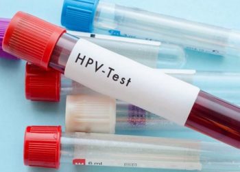 Xét nghiệm HPV có những phương pháp nào chẩn đoán chuẩn?