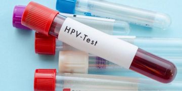Xét nghiệm HPV có những phương pháp nào chẩn đoán chuẩn?