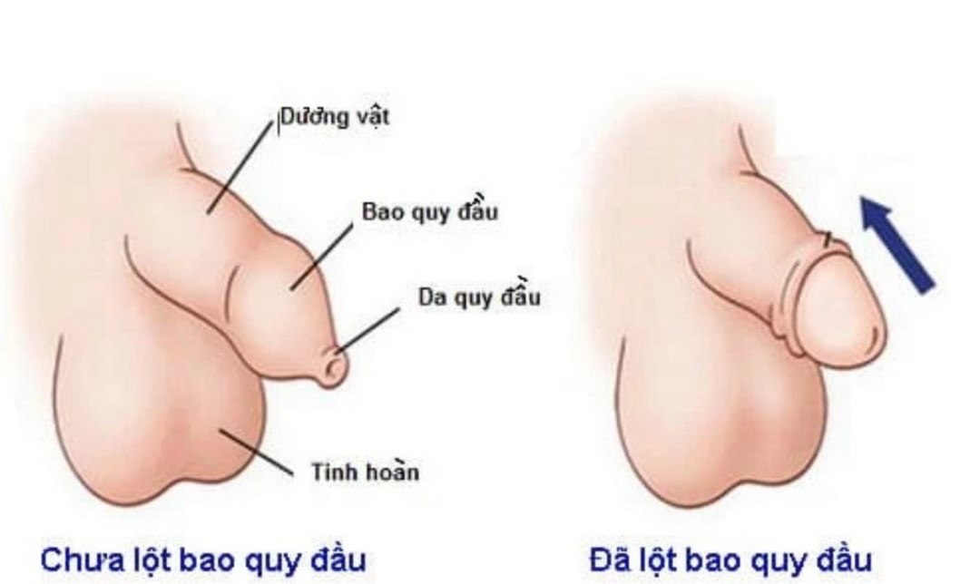 Cách thực hiện đối với trẻ em