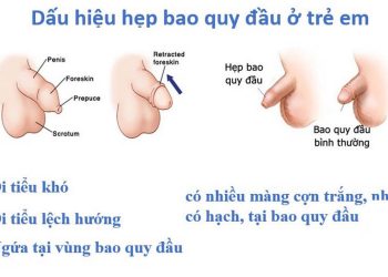 Những Triệu Chứng Của Hẹp Bao Quy Đầu