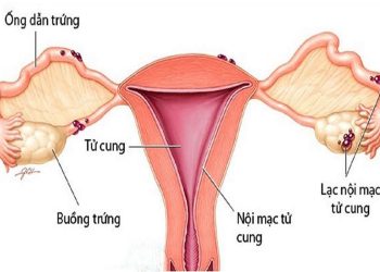 Rối loạn nội tiết tố