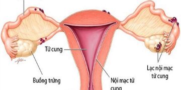 Rối loạn nội tiết tố