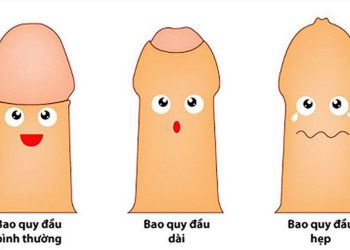 Tìm hiểu về bệnh hẹp bao quy đầu