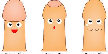 Tìm hiểu về bệnh hẹp bao quy đầu