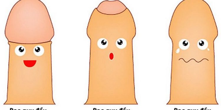 Tìm hiểu về bệnh hẹp bao quy đầu