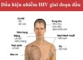 Suy giảm miễn dịch