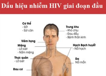 Suy giảm miễn dịch