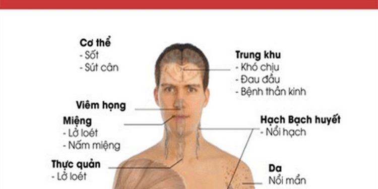 Suy giảm miễn dịch