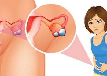 Dấu hiệu nhận biết bệnh
