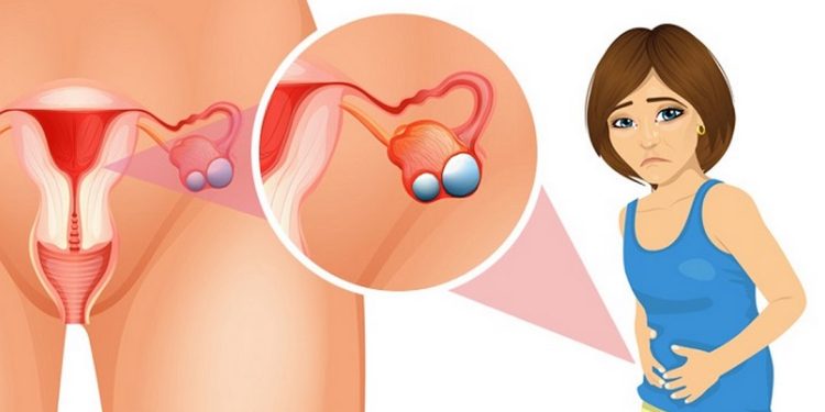 Dấu hiệu nhận biết bệnh