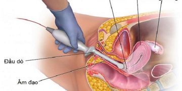 U nang có thể lành tính