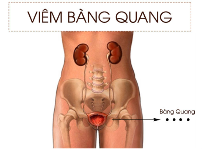 Uống đủ nước sẽ giúp bạn tiểu thường xuyên